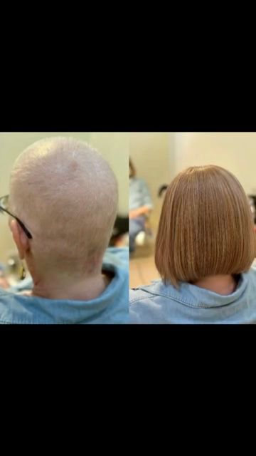 Wigs