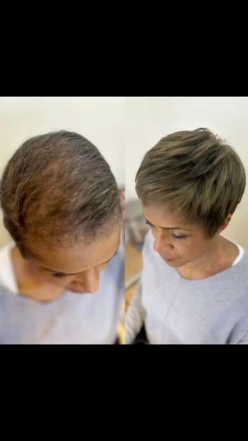 Wigs